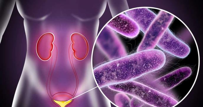 Prevención de infecciones urinarias