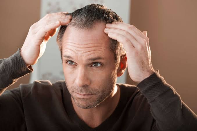 hombre con caída de cabello